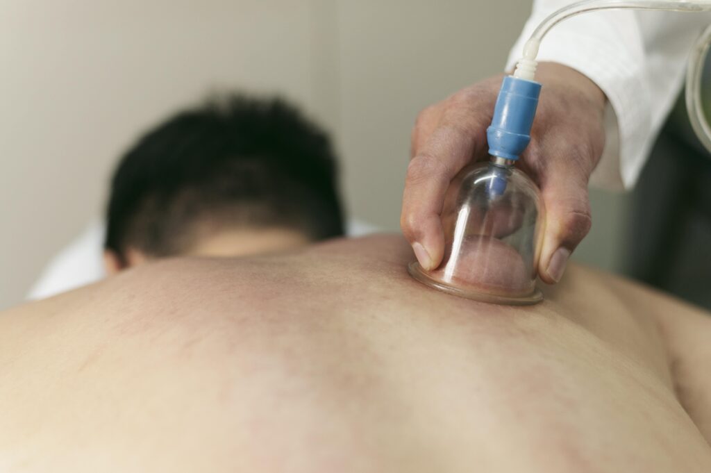 Cupping Therapy (Hijama) in Keshavnagar, Mundhwa | Rudrani