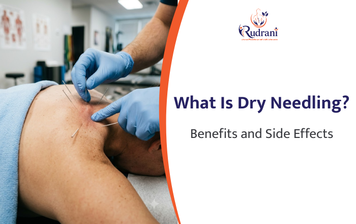 What Is Dry Needling? Benefits, Side Effects, and What to Expect